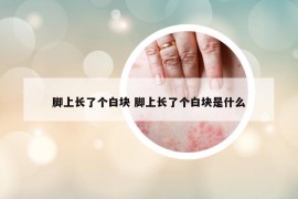 腳上長(zhǎng)了個(gè)白塊 腳上長(zhǎng)了個(gè)白塊是什么