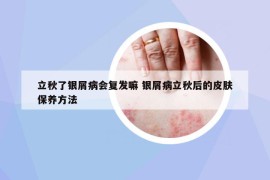 立秋了銀屑病會(huì)復(fù)發(fā)嘛 銀屑病立秋后的皮膚保養(yǎng)方法
