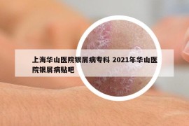 上海華山醫(yī)院銀屑病?？?2021年華山醫(yī)院銀屑病貼吧
