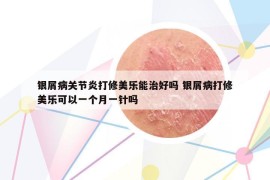 銀屑病關(guān)節(jié)炎打修美樂能治好嗎 銀屑病打修美樂可以一個月一針嗎