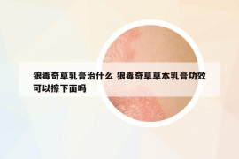 狼毒奇草乳膏治什么 狼毒奇草草本乳膏功效可以擦下面嗎