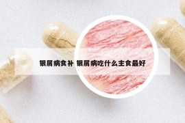 銀屑病食補(bǔ) 銀屑病吃什么主食最好