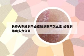 長(zhǎng)春火車(chē)站到華山皮膚病醫(yī)院怎么走 長(zhǎng)春到華山多少公里