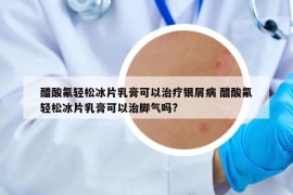 醋酸氟輕松冰片乳膏可以治療銀屑病 醋酸氟輕松冰片乳膏可以治腳氣嗎?