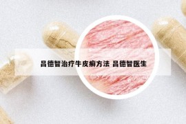 呂德智治療牛皮癬方法 呂德智醫(yī)生