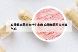 白醋跟大蒜能治療牛皮癬 白醋和蒜可以治腳氣嗎