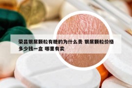 榮昌銀屑顆粒有糖的為什么貴 銀屑顆粒價(jià)格多少錢一盒 哪里有賣