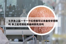 七歲身上起一個一個紅疙瘩可以拿曲安奈德擦嗎 身上起疙瘩能用曲咪新乳膏嗎