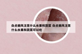 白點癲風(fēng)注意什么水果和蔬菜 白點癲風(fēng)注意什么水果和蔬菜可以吃