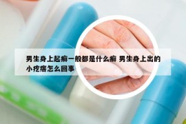 男生身上起癬一般都是什么癬 男生身上出的小疙瘩怎么回事