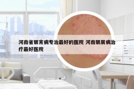 河南省銀宵病專治最好的醫(yī)院 河南銀屑病治療最好醫(yī)院