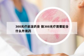 308光療前涂藥膏 做308光療需要配合什么外用藥