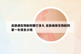 皮膚病生物制劑要打多久 皮膚病用生物制劑第一年得多少錢