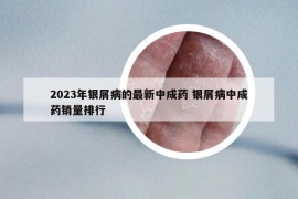 2023年銀屑病的最新中成藥 銀屑病中成藥銷量排行
