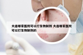 大連哪家醫(yī)院可以打生物制劑 大連哪家醫(yī)院可以打生物制劑的