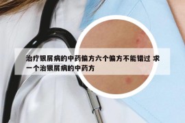 治療銀屑病的中藥偏方六個偏方不能錯過 求一個治銀屑病的中藥方