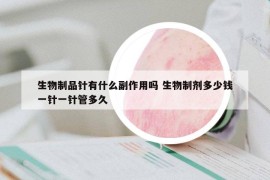 生物制品針有什么副作用嗎 生物制劑多少錢一針一針管多久