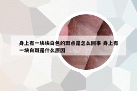 身上有一塊塊白色的斑點(diǎn)是怎么回事 身上有一塊白斑是什么原因