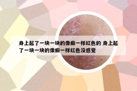 身上起了一塊一塊的像癬一樣紅色的 身上起了一塊一塊的像癬一樣紅色沒(méi)感覺