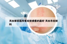 天水那家醫(yī)院看皮膚病看的最好 天水市皮膚科