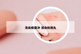 清血癬康凈 清血除癬丸
