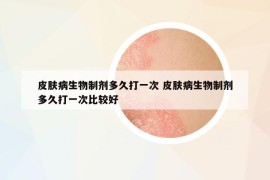 皮膚病生物制劑多久打一次 皮膚病生物制劑多久打一次比較好