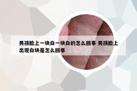 男孩臉上一塊白一塊白的怎么回事 男孩臉上出現(xiàn)白塊是怎么回事