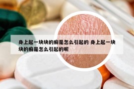 身上起一塊塊的癬是怎么引起的 身上起一塊塊的癬是怎么引起的呢