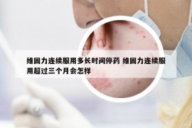 維固力連續(xù)服用多長時間停藥 維固力連續(xù)服用超過三個月會怎樣