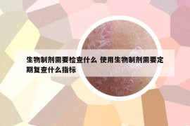生物制劑需要檢查什么 使用生物制劑需要定期復(fù)查什么指標(biāo)