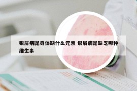 銀屑病是身體缺什么元素 銀屑病是缺乏哪種維生素
