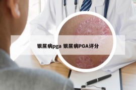 銀屑病pga 銀屑病PGA評(píng)分