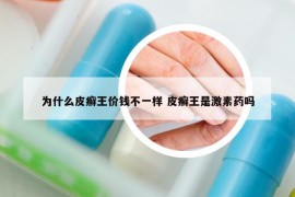 為什么皮癬王價(jià)錢不一樣 皮癬王是激素藥嗎