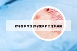 脖子里長白斑 脖子里長白斑什么原因