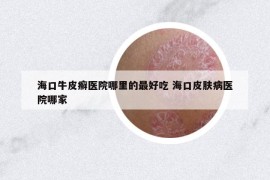 ?？谂Ｆぐ_醫(yī)院哪里的最好吃 ?？谄つw病醫(yī)院哪家