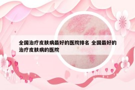 全國治療皮膚病最好的醫(yī)院排名 全國最好的治療皮膚病的醫(yī)院