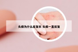 頭癬為什么反復(fù)長(zhǎng) 頭癬一直反復(fù)