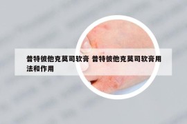 普特彼他克莫司軟膏 普特彼他克莫司軟膏用法和作用