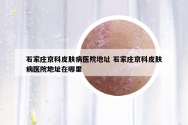 石家莊京科皮膚病醫(yī)院地址 石家莊京科皮膚病醫(yī)院地址在哪里