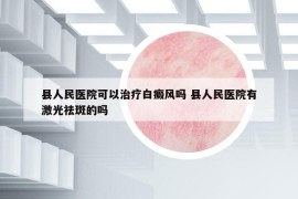 縣人民醫(yī)院可以治療白癜風(fēng)嗎 縣人民醫(yī)院有激光祛斑的嗎
