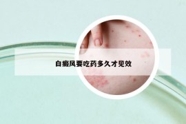 白癜風(fēng)要吃藥多久才見效