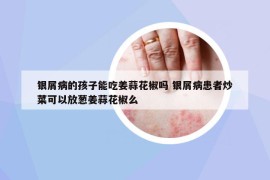 銀屑病的孩子能吃姜蒜花椒嗎 銀屑病患者炒菜可以放蔥姜蒜花椒么