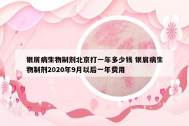 銀屑病生物制劑北京打一年多少錢(qián) 銀屑病生物制劑2020年9月以后一年費(fèi)用
