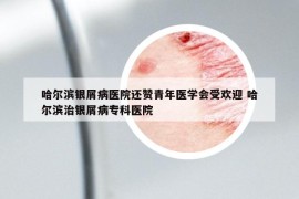 哈爾濱銀屑病醫(yī)院還贊青年醫(yī)學(xué)會(huì)受歡迎 哈爾濱治銀屑病?？漆t(yī)院