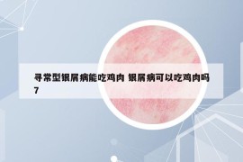 尋常型銀屑病能吃雞肉 銀屑病可以吃雞肉嗎7