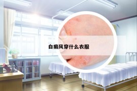 白癜風穿什么衣服
