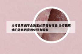 治療銀屑病不含激素的藥膏有哪些 治療銀屑病的外用藥膏哪些沒(méi)有激素