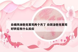白癜風抹他克莫司兩個月了 白斑涂他克莫司好轉(zhuǎn)后有什么反應(yīng)