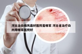 河北治白癜風(fēng)最好醫(yī)院是哪家 河北省治療白內(nèi)障哪家醫(yī)院好