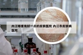內(nèi)江哪里有好一點(diǎn)的皮膚醫(yī)院 內(nèi)江市皮膚病醫(yī)院